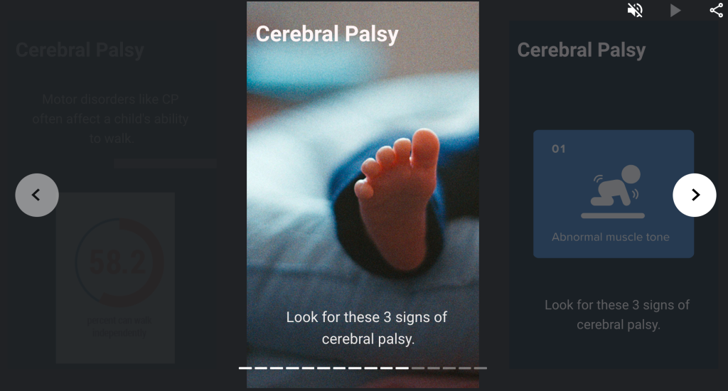 Cerebral palsy explained by Michigan birth injury lawyers at Sommers Schwartz