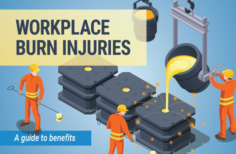 Hatfield Burn Injuries