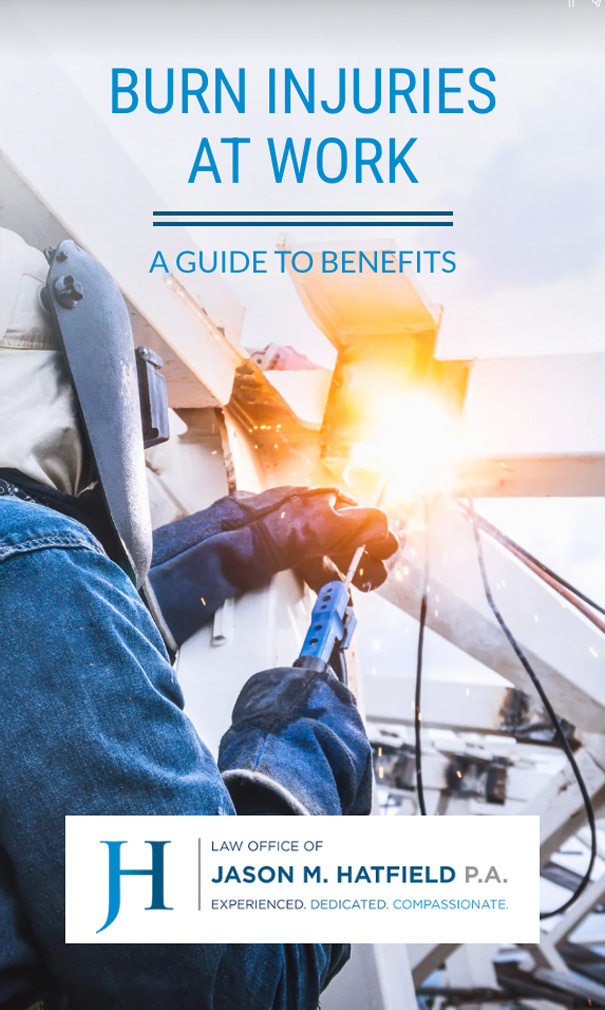 Burn Injuries at Work Web Story