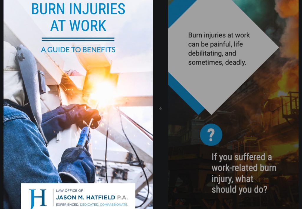 Web Story: Burn Injuries at Work