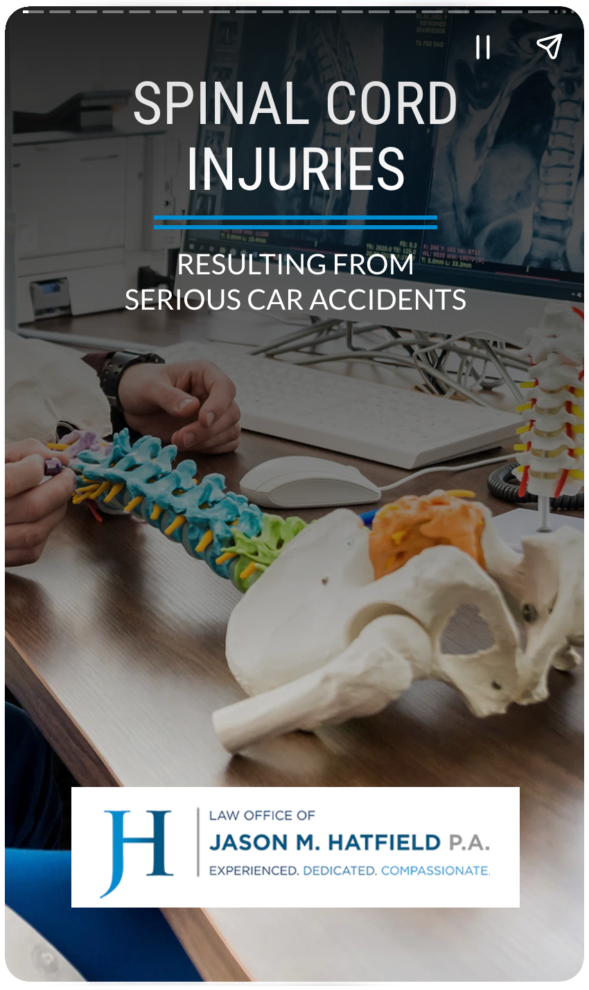 Spinal Cord Injury from a Car Accident 1 Web Story: Spine Injuries from Car Accidents