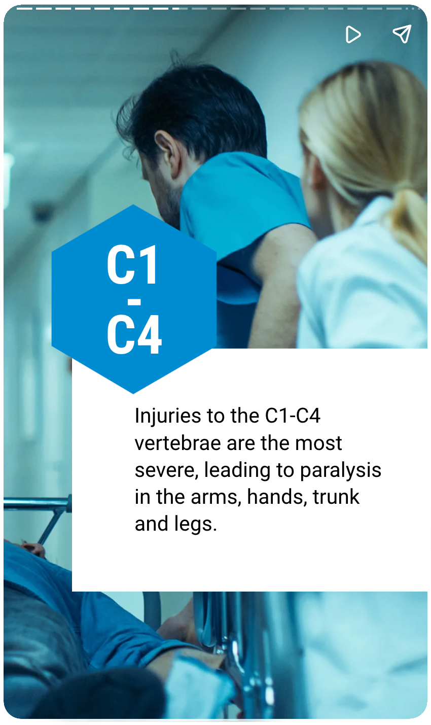 Spinal Cord Injury from a Car Accident 4 Web Story: Spine Injuries from Car Accidents