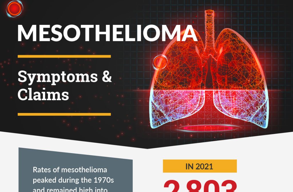 Mesothelioma symptoms and claims